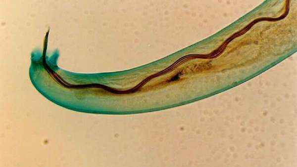 Un parásito que invade el cerebro tiene en alerta a Hawái
