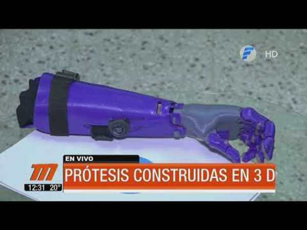 Convenio para adquirir prótesis construidas en 3D