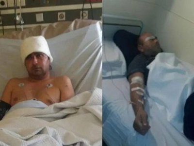 Paraguayo perdió un ojo al ser atacado por 20 asaltantes en Buenos Aires