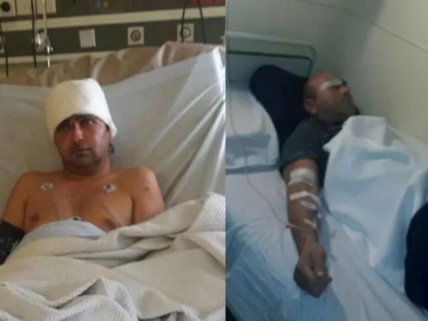 Paraguayo perdió un ojo al ser atacado por 20 asaltantes en Buenos Aires