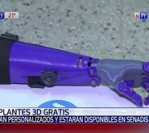 Beneficiarán con prótesis 3D gratis en la Senadis - Paraguay.com