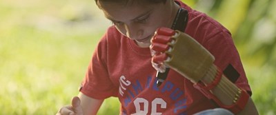 Personas con discapacidad y de escasos recursos podrán acceder a prótesis 3D