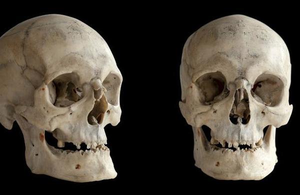 Encuentran misterioso cráneo alargado: tendría unos 1.000 años de antigüedad - C9N