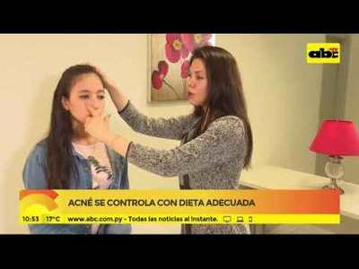 Acné se controla con dieta adecuada - Tv - ABC Color
