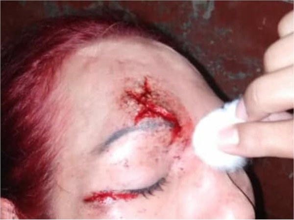 Cuatro hombres golpearon con varilla de hierro a un travesti