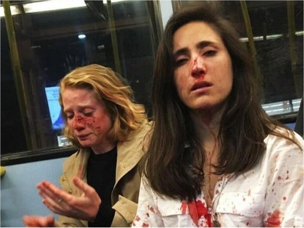 Una pareja de mujeres sufre brutal ataque homofóbico en Londres