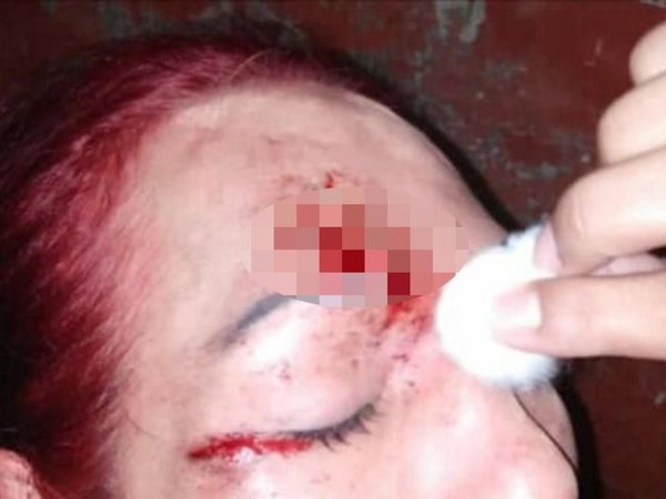 Travesti brutalmente golpeada se recupera, pero ya van 30 agresiones a trans este año