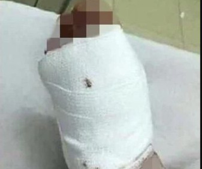 Confundió pie de su doña con víbora, y ¡zas!
