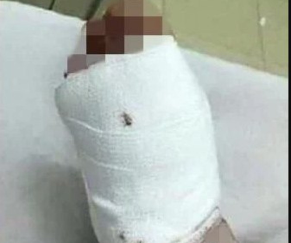 Confundió pie de su doña con víbora, y ¡zas!