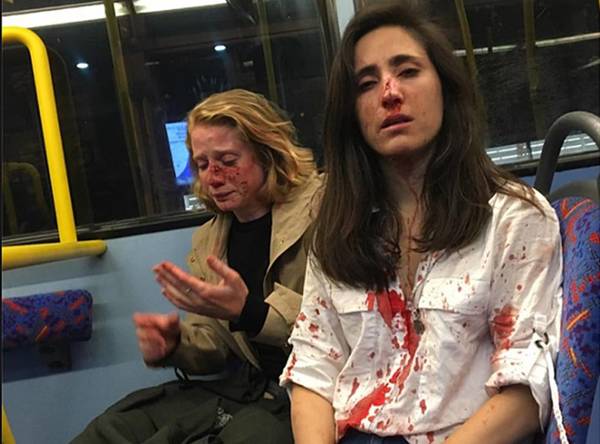 Arrestan al quinto sospechoso del ataque a una pareja lesbiana en Londres » Ñanduti