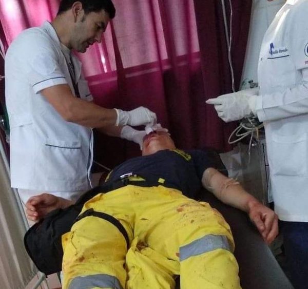 Bombero en estado grave tras ser atropellado en Minga Guazú