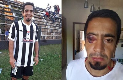 Hubo pelea pero la foto es falsa - Deportes - ABC Color