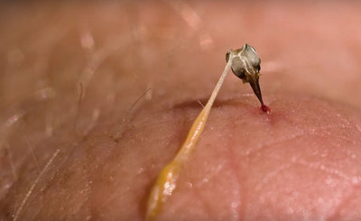 Apitox, el medicamento homeopático, natural, elaborado con veneno de abeja » Ñanduti