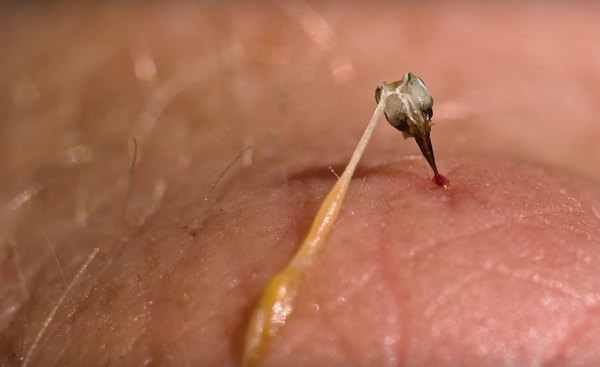 Apitox, el medicamento homeopático, natural, elaborado con veneno de abeja » Ñanduti