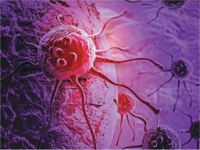 Análisis matemático de imágenes tumorales ayuda a prever agresividad de cáncer