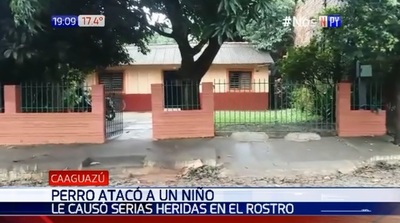 Caaguazú: Perro ataca a niño y lo hiere gravemente en el rostro | Noticias Paraguay