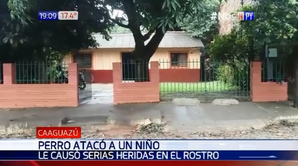 Caaguazú: Perro ataca a niño y lo hiere gravemente en el rostro | Noticias Paraguay