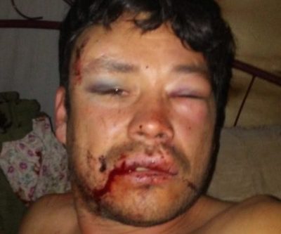Dos jóvenes casi matan a golpes a un padre de familia