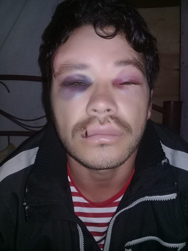 Apaleado hasta la inconsciencia por dos vecinos anuncia querella criminal