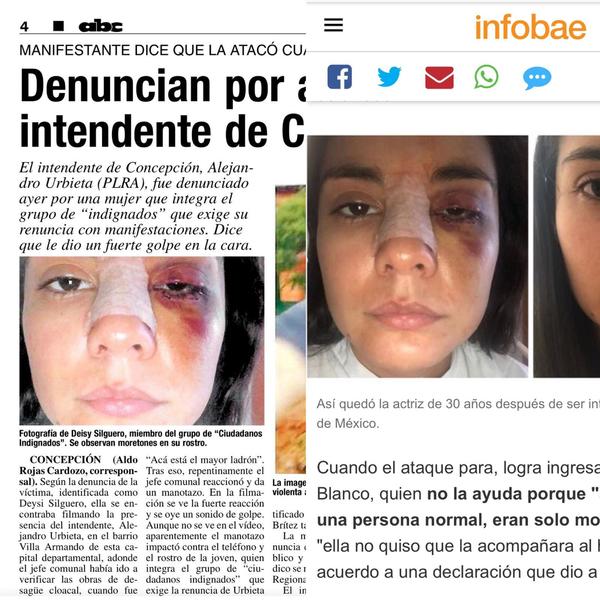 PAPELÓN: ABC Color utiliza imagen falsa de mujer golpeada en el caso del intendente Urbieta