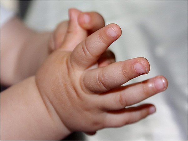 Bebé de 6 meses requiere con urgencia de cama de terapia