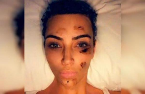 Kim Kardashian consulta a un médium para solucionar su enfermedad a la piel - C9N