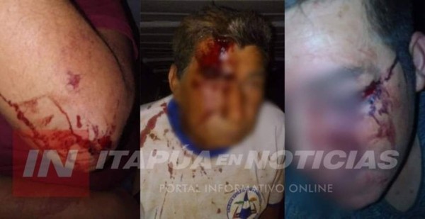 Detienen a hombre que acuchilló a su hermana y golpeó a su padre