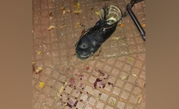 Disparo accidental deja herido a guardia