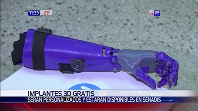 Beneficiarán con prótesis 3D gratis en la Senadis | Noticias Paraguay