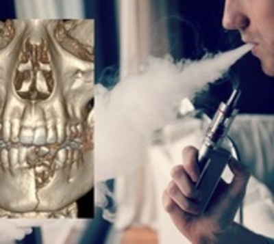 Le explotó el 'vape' y le rompió la mandíbula - Paraguay.com