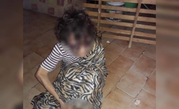 HOY / Atada a la cama, golpeada y desnutrida: hombre detenido por torturar a su propia madre
