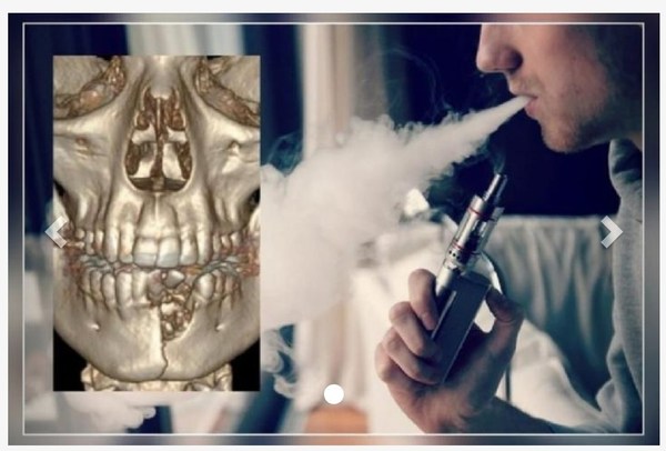Le explotó el "vape" y le rompió la mandíbula - Digital Misiones