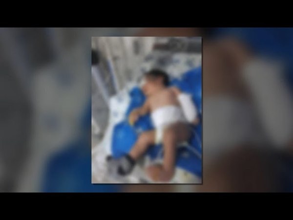 JOVEN MADRE DIO A LUZ EN EL HRE Y SUP. CUANDO VIO A SU BEBA LA ENCONTRÓ CON EL BRAZO ROTO