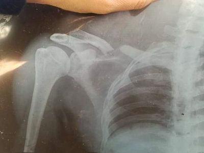 Familia humilde acude a solidaridad para salir adelante