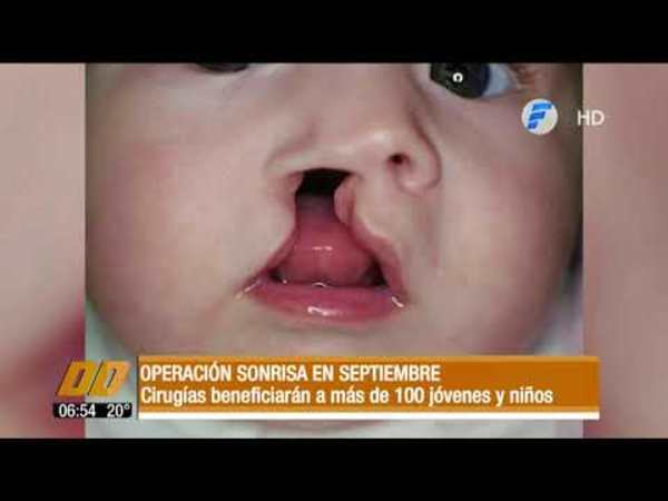 Operación Sonrisa en septiembre