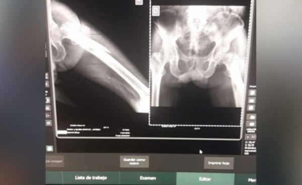 Hospital Regional cuenta con Rayos X Digital