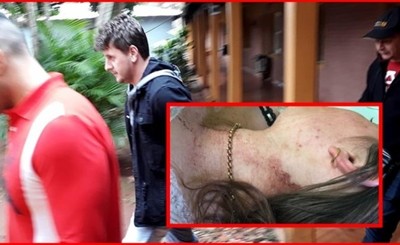 Hijo de concejal detenido por salvaje agresión a su ex pareja