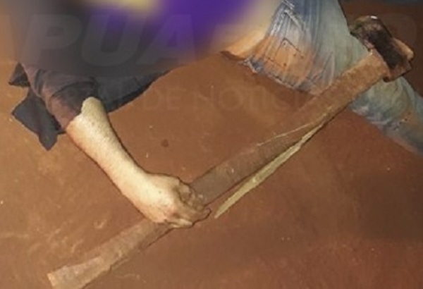 Hombre atacó a su vecina con un hacha y lo mataron a balazos