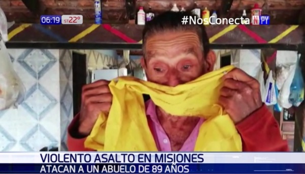 Asaltan a anciano de 89 años | Noticias Paraguay