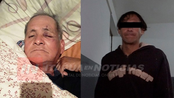 IRÁ A LA CÁRCEL TRAS FRACTURAR A GOLPES COSTILLA DE SU PADRE.