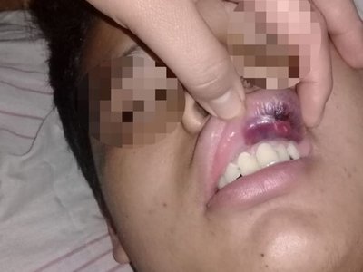 No quiso darles la cerveza y le molieron a trompadas