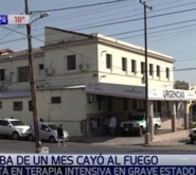 Beba que cayó al fuego se recupera en Hospital del Quemado  - Paraguay.com