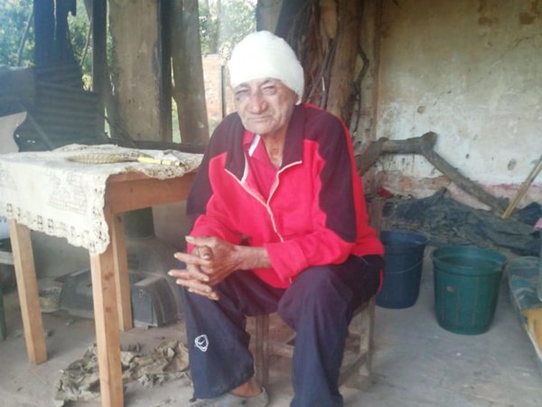 Casi desfiguraron a abuelito para robarle 400.000 guaraníes