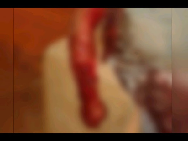 HOMBRE CASI PIERDE EL BRAZO AL SER ATACADO POR UN PERRO