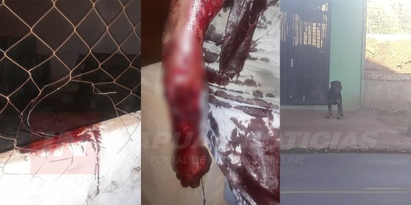 ROTTWEILLER DESTROZA BRAZO DE UN HOMBRE EN EL B° SAN ISIDRO.