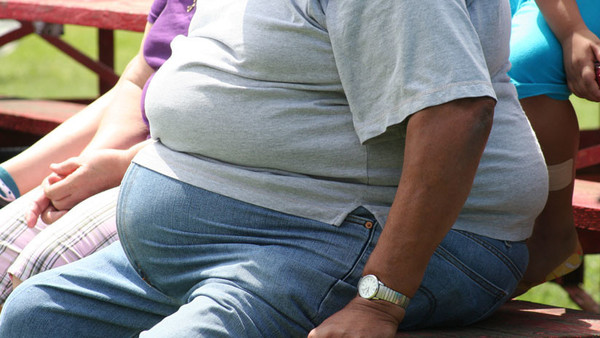 Las dos enfermedades más grandes de América Latina: Obesidad y hambre - ADN Paraguayo