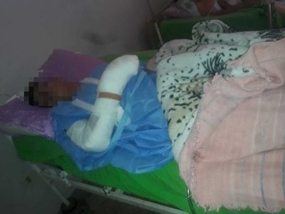 Amputarán la mano al joven que se accidentó haciendo mosto