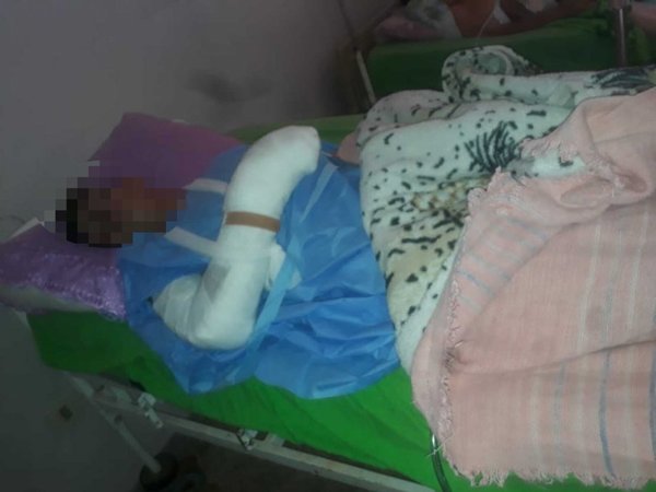 Amputarán la mano al joven que se accidentó haciendo mosto