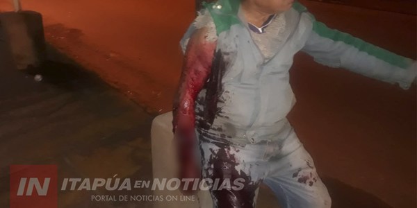 AMPUTAN EL BRAZO AL HOMBRE ATACADO POR EL ROTTWEILLER EN SAN ISIDRO.