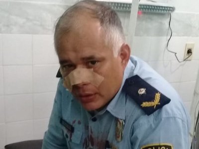Yaguarón: Policías heridos tras pelea entre hinchas de fútbol